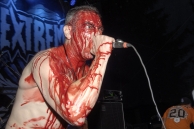 HAEMORRHAGE